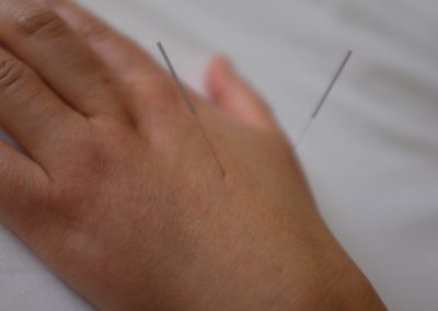 Médicine traditionnelle chinoise